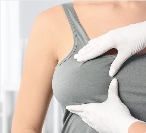 Breast reduction