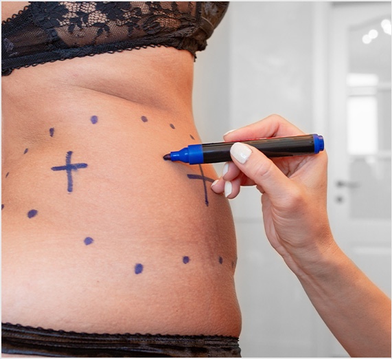 marker on stomach