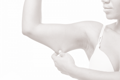 Arm Lift